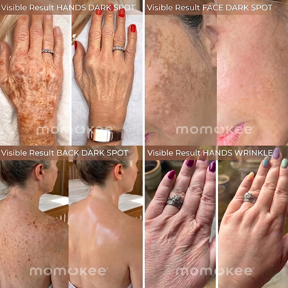 momukee® Retinol Firming & Whitening Body Lotion