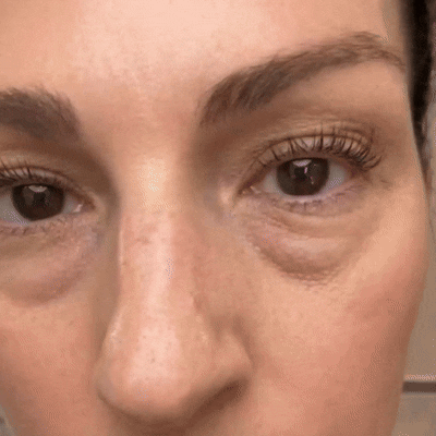 momokee® 𝐂𝐚𝐥𝐜𝐢𝐮𝐦 𝐕𝐨𝐥𝐮𝐦𝐞 Botox Balm