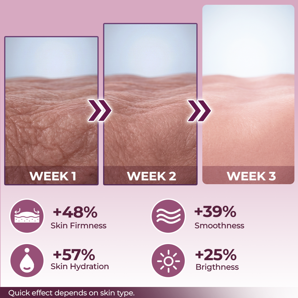 Momokee® Calcium Volume Botox Balm