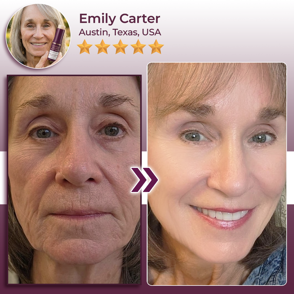Momokee® Calcium Volume Botox Balm