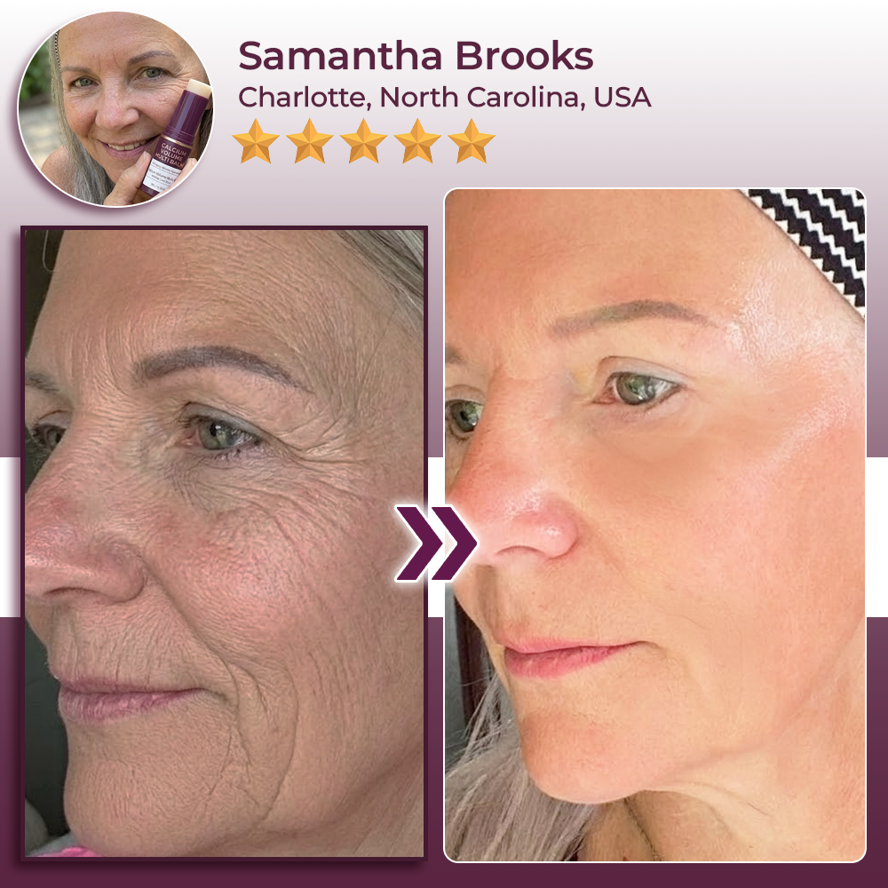 Momokee® Calcium Volume Botox Balm