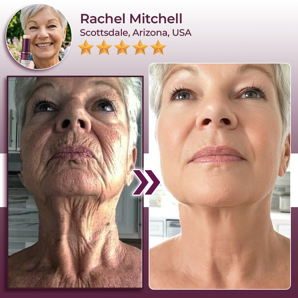 Momokee® Calcium Volume Botox Balm