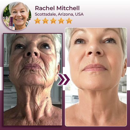 Momokee® Calcium Volume Botox Balm